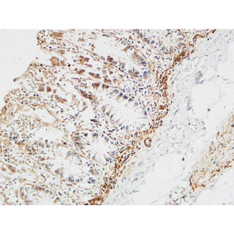 Immunohistochemistry - Anti-PTX3 Antibody (C10482) - Antibodies.com