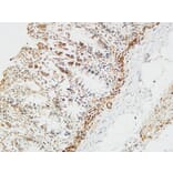 Immunohistochemistry - Anti-PTX3 Antibody (C10482) - Antibodies.com