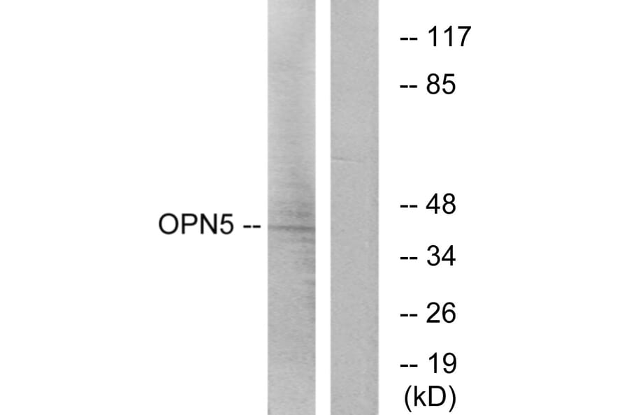 Western Blot - Anti-OPN5 Antibody (G489) - Antibodies.com