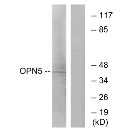 Western Blot - Anti-OPN5 Antibody (G489) - Antibodies.com