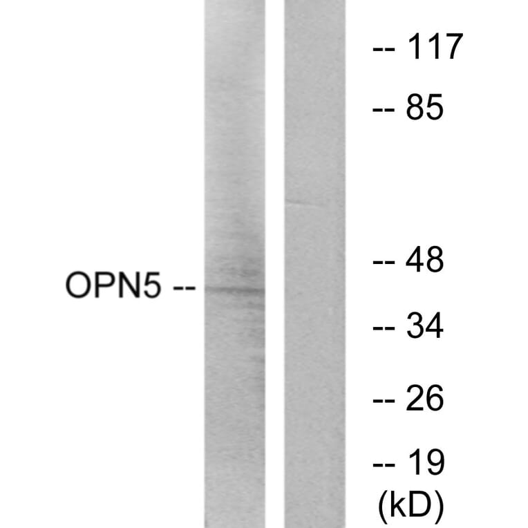 Western Blot - Anti-OPN5 Antibody (G489) - Antibodies.com