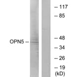Western Blot - Anti-OPN5 Antibody (G489) - Antibodies.com