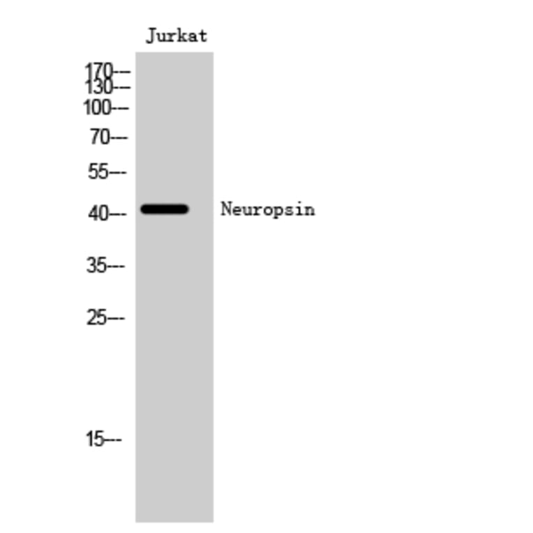Western Blot - Anti-OPN5 Antibody (G489) - Antibodies.com