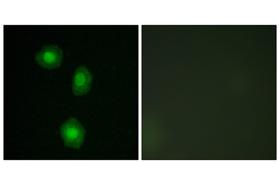 Immunofluorescence - Anti-MSK1 Antibody (B7155) - Antibodies.com