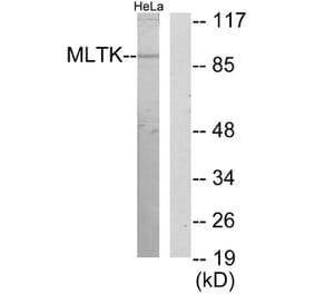 Western Blot - Anti-MLTK Antibody (C11781) - Antibodies.com