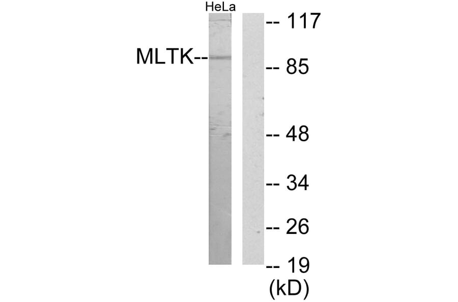 Western Blot - Anti-MLTK Antibody (C11781) - Antibodies.com