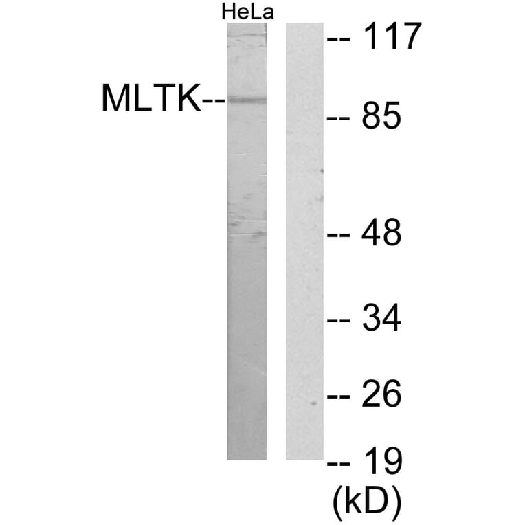 Western Blot - Anti-MLTK Antibody (C11781) - Antibodies.com