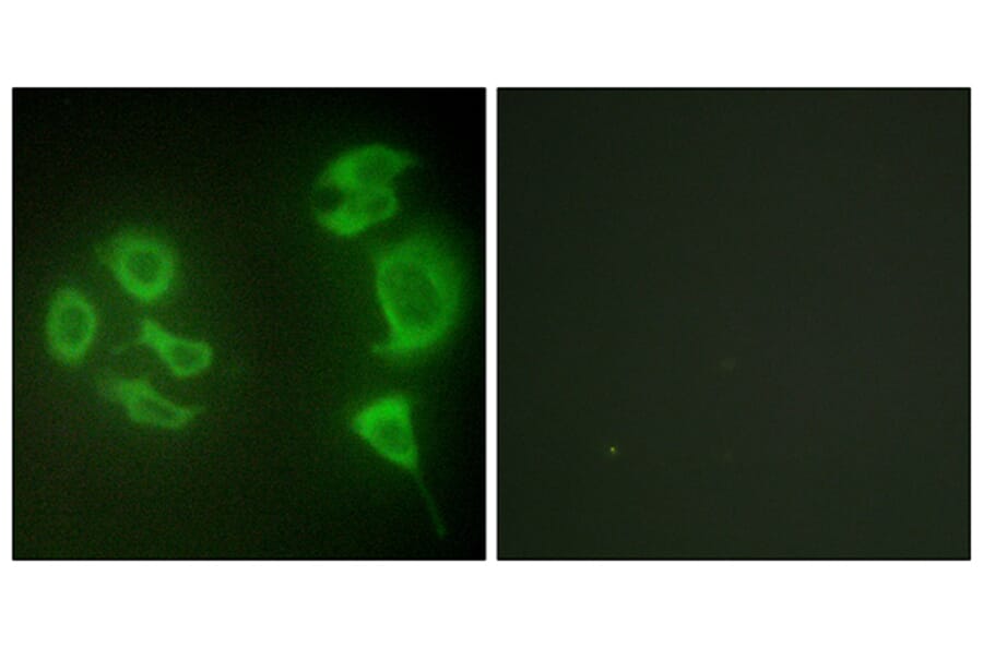 Immunofluorescence - Anti-MLTK Antibody (C11781) - Antibodies.com
