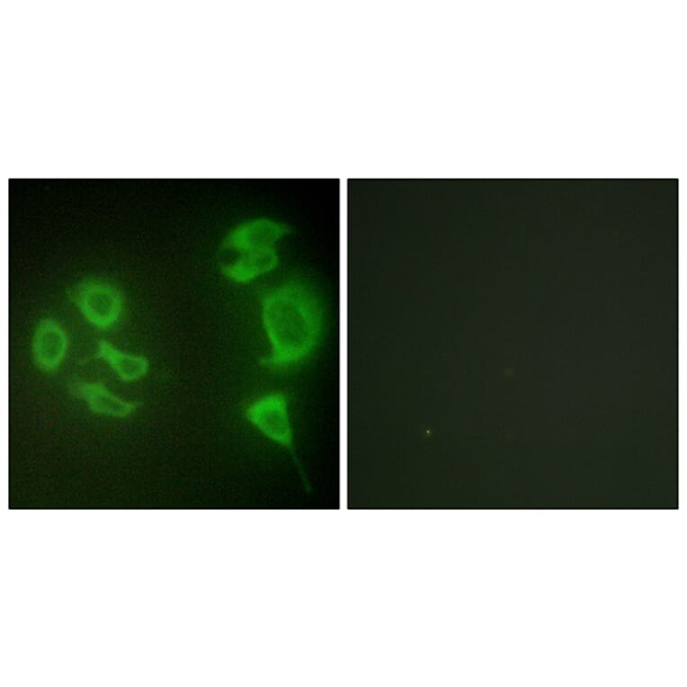 Immunofluorescence - Anti-MLTK Antibody (C11781) - Antibodies.com