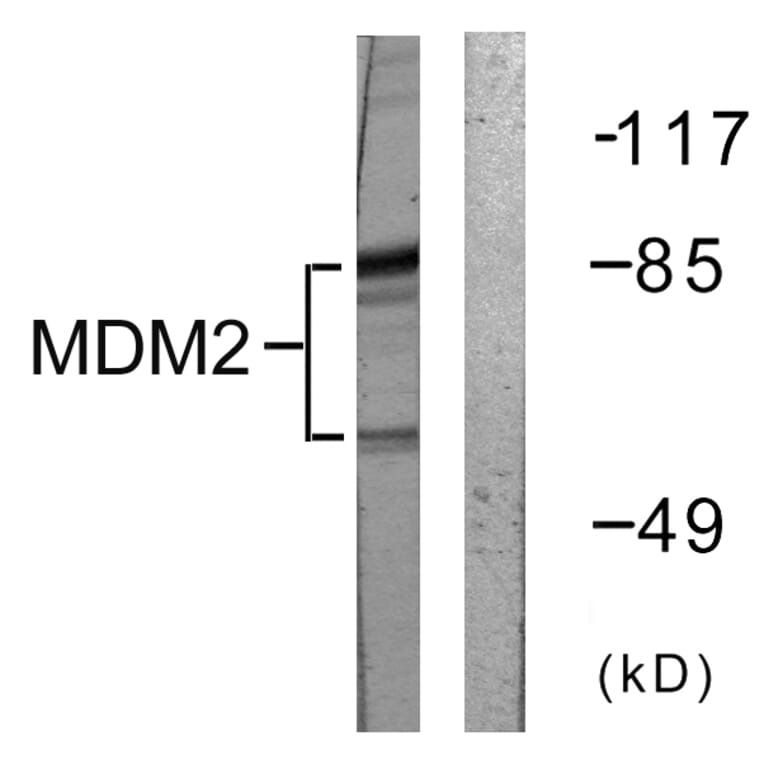 Western Blot - Anti-MDM2 Antibody (B0508) - Antibodies.com