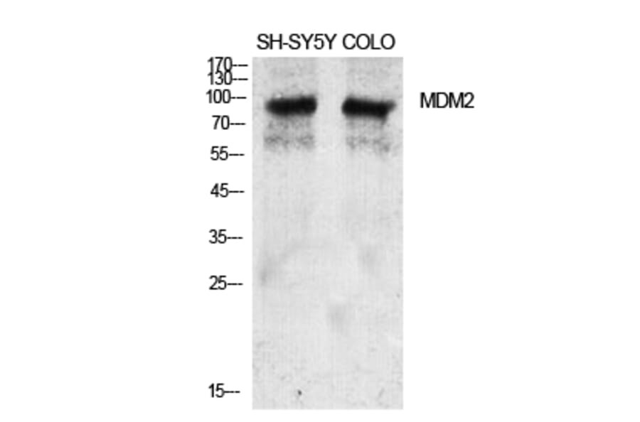 Western Blot - Anti-MDM2 Antibody (B0508) - Antibodies.com