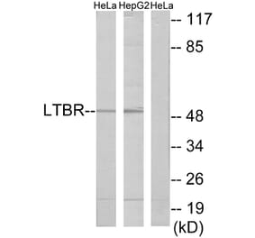 Western Blot - Anti-LTBR Antibody (C10577) - Antibodies.com