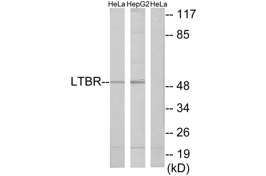 Western Blot - Anti-LTBR Antibody (C10577) - Antibodies.com