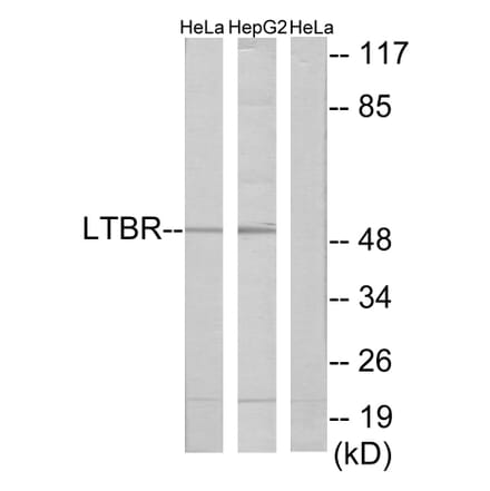 Western Blot - Anti-LTBR Antibody (C10577) - Antibodies.com