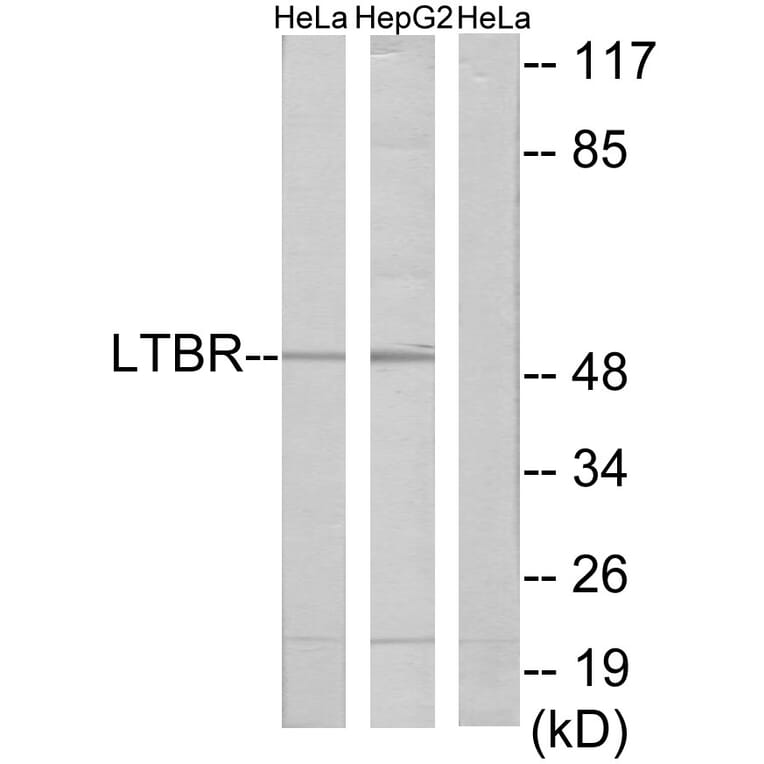 Western Blot - Anti-LTBR Antibody (C10577) - Antibodies.com