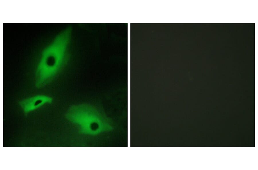 Immunofluorescence - Anti-LTBR Antibody (C10577) - Antibodies.com
