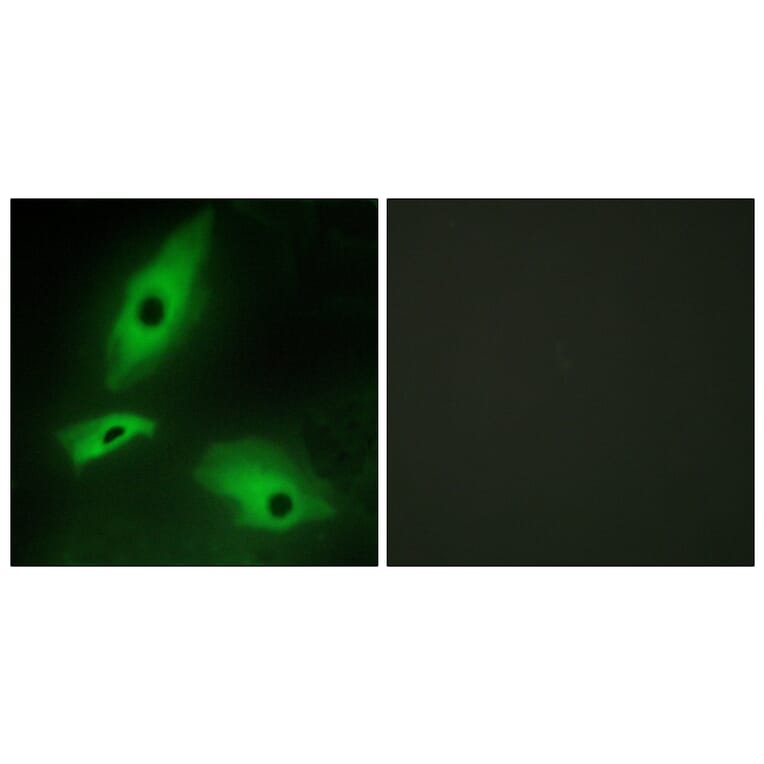 Immunofluorescence - Anti-LTBR Antibody (C10577) - Antibodies.com