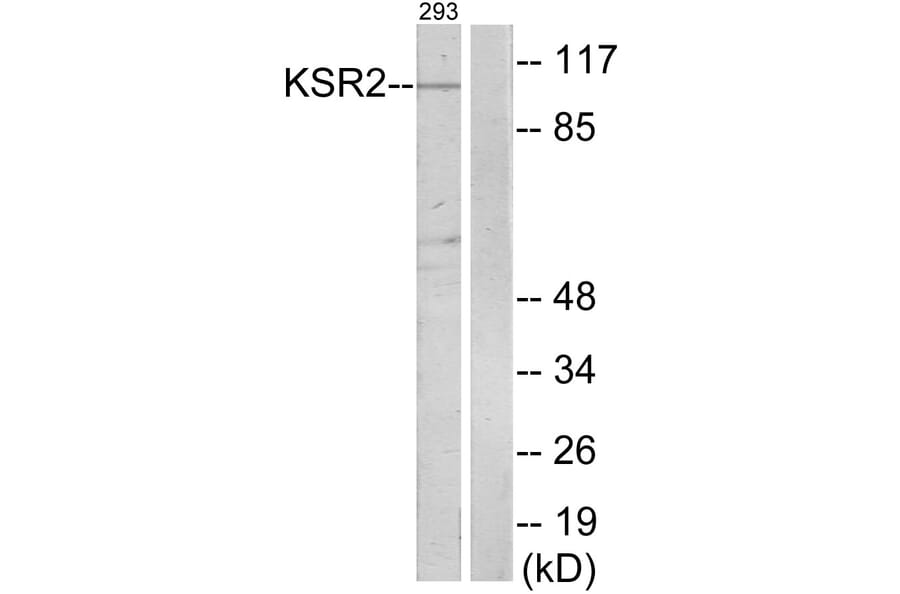 Western Blot - Anti-KSR2 Antibody (C11236) - Antibodies.com