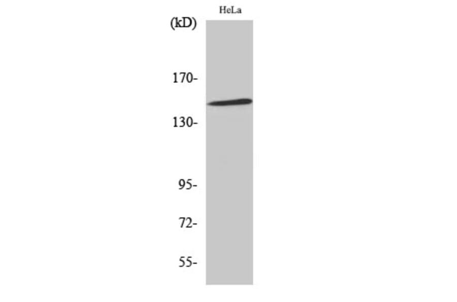 Western Blot - Anti-JIP3 Antibody (C11903) - Antibodies.com