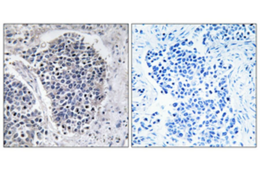 Immunohistochemistry - Anti-JIP3 Antibody (C11903) - Antibodies.com