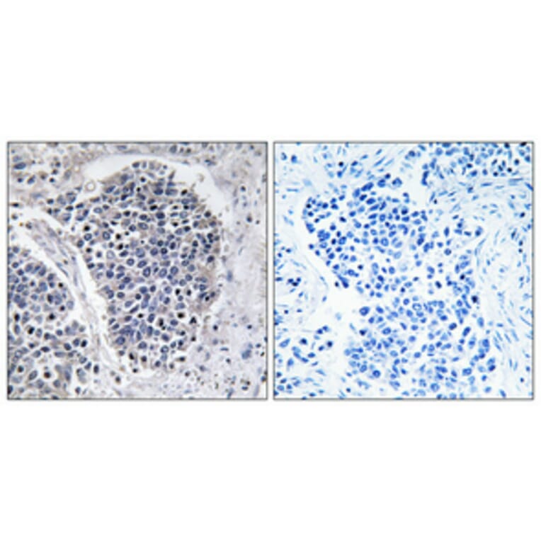 Immunohistochemistry - Anti-JIP3 Antibody (C11903) - Antibodies.com