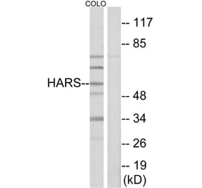 Western Blot - Anti-HARS Antibody (C10349) - Antibodies.com