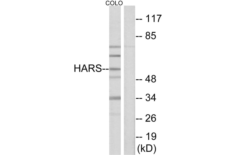 Western Blot - Anti-HARS Antibody (C10349) - Antibodies.com