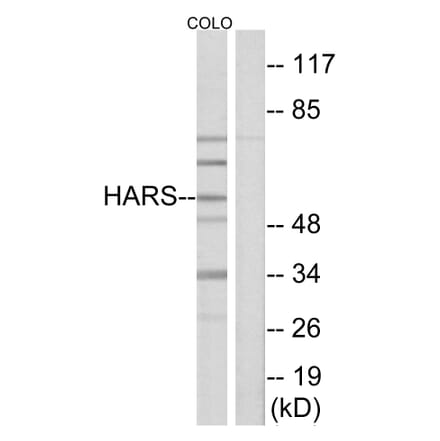 Western Blot - Anti-HARS Antibody (C10349) - Antibodies.com