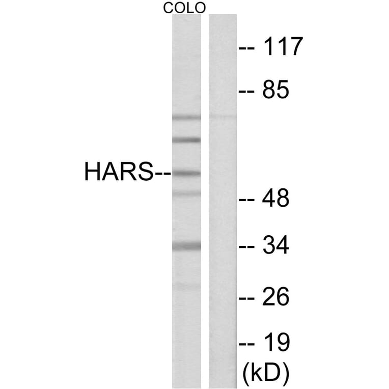Western Blot - Anti-HARS Antibody (C10349) - Antibodies.com