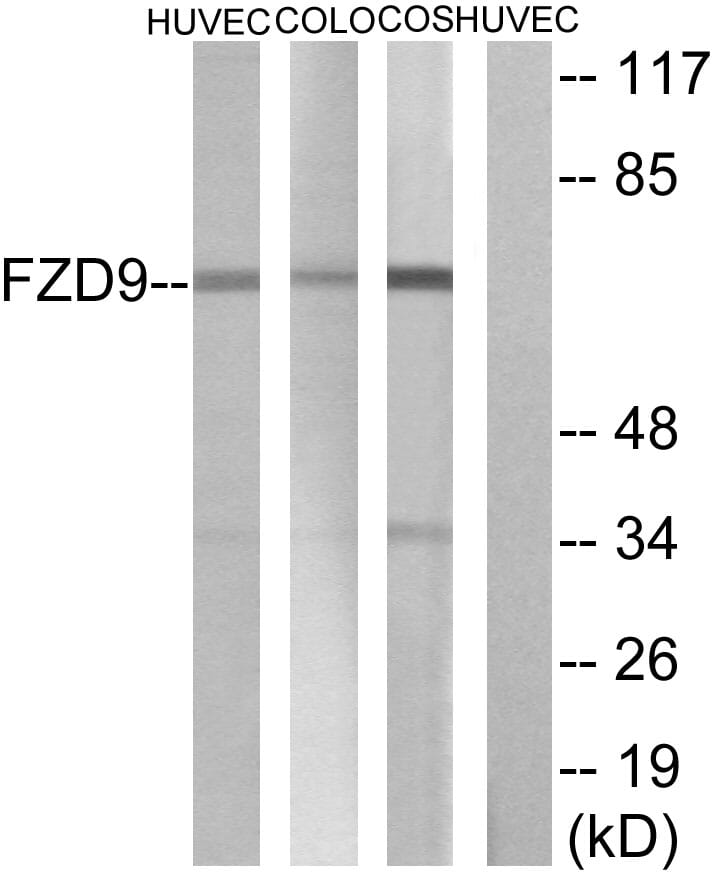 Western blot analysis of lysates from HUVEC, COLO, and COS cells using Anti-FZD9 Antibody. The right hand lane represents a negative control, where the antibody is blocked by the immunising peptide.