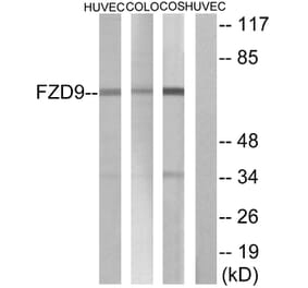 Western Blot - Anti-FZD9 Antibody (G114) - Antibodies.com