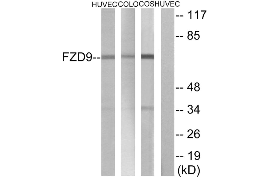 Western Blot - Anti-FZD9 Antibody (G114) - Antibodies.com