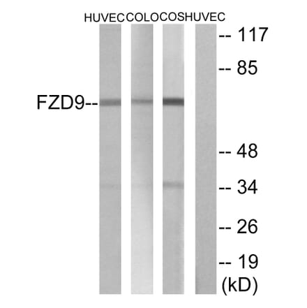 Western Blot - Anti-FZD9 Antibody (G114) - Antibodies.com