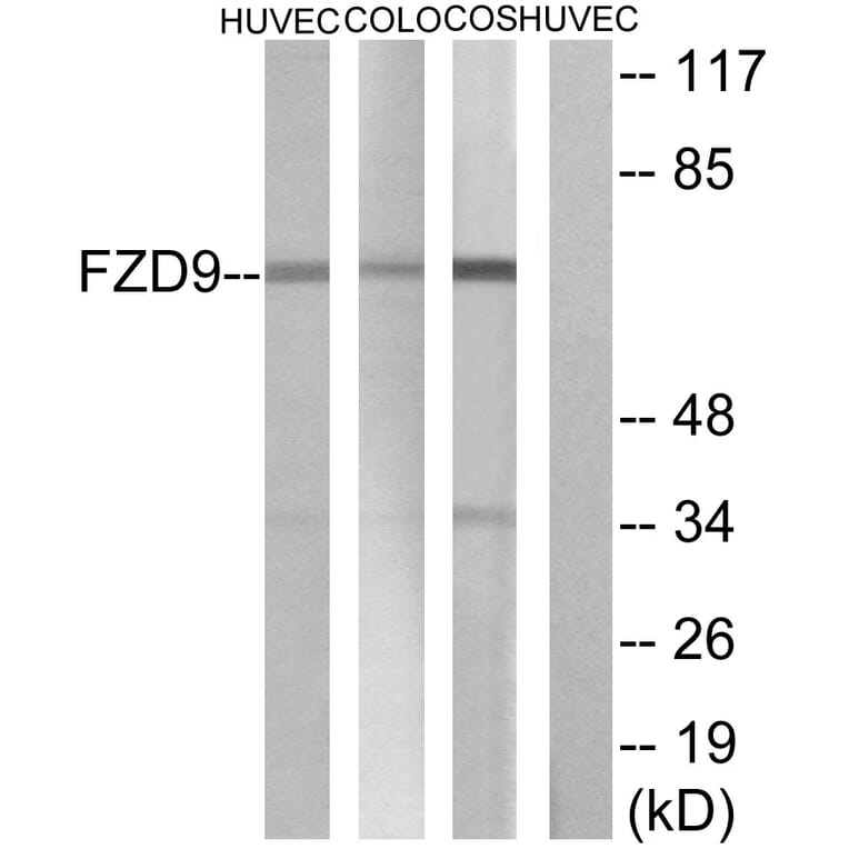 Western Blot - Anti-FZD9 Antibody (G114) - Antibodies.com