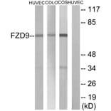 Western Blot - Anti-FZD9 Antibody (G114) - Antibodies.com