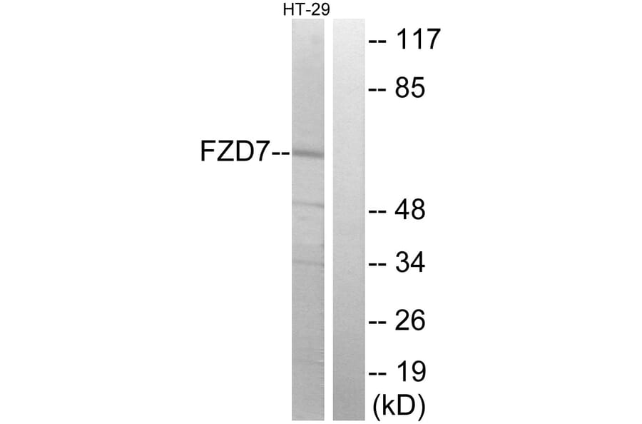 Western Blot - Anti-FZD7 Antibody (G112) - Antibodies.com