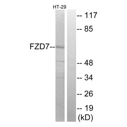Western Blot - Anti-FZD7 Antibody (G112) - Antibodies.com