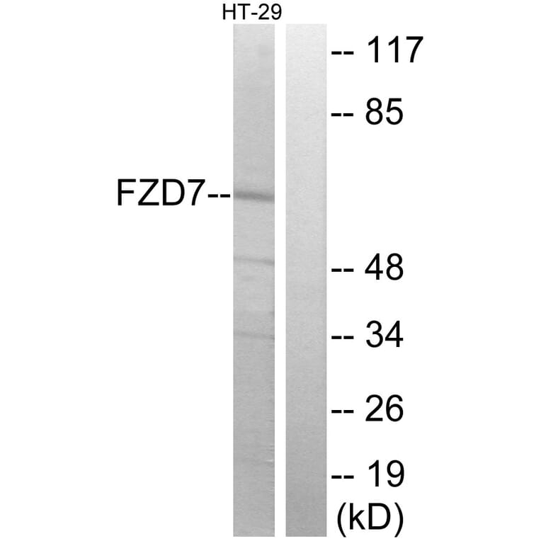 Western Blot - Anti-FZD7 Antibody (G112) - Antibodies.com