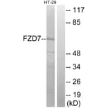 Western Blot - Anti-FZD7 Antibody (G112) - Antibodies.com