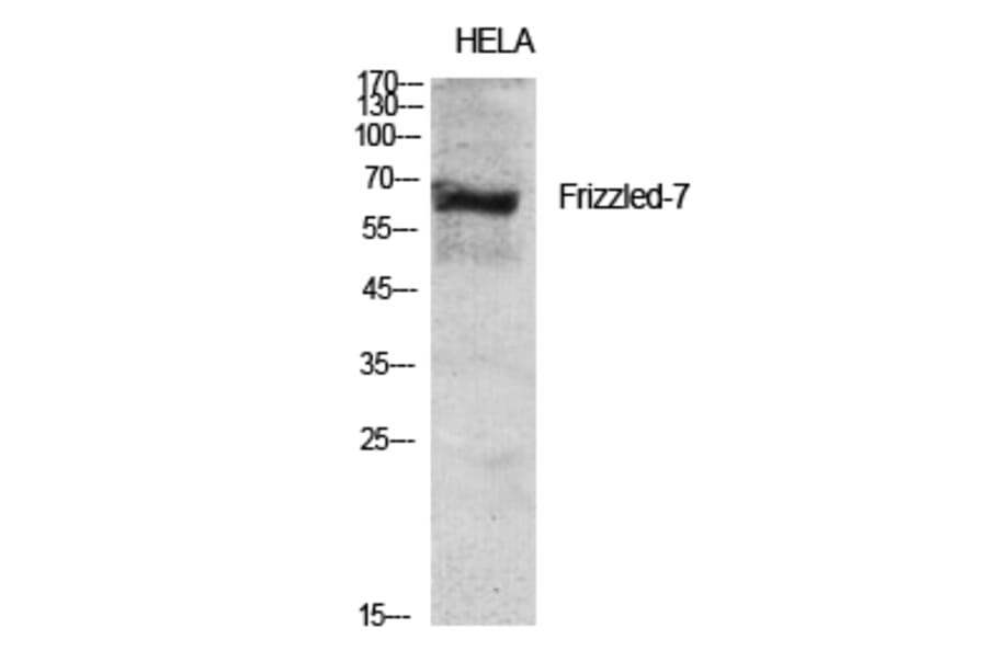 Western Blot - Anti-FZD7 Antibody (G112) - Antibodies.com