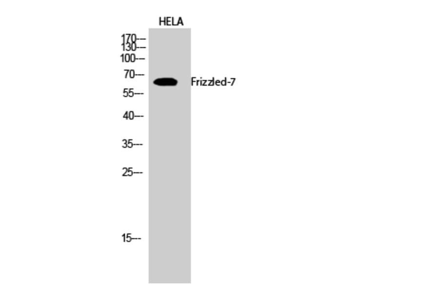Western Blot - Anti-FZD7 Antibody (G112) - Antibodies.com