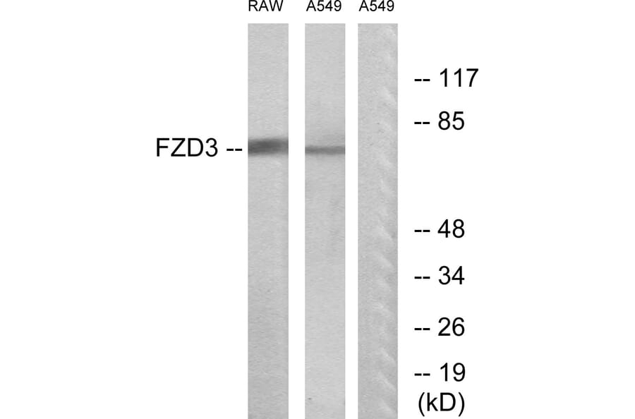 Western Blot - Anti-FZD3 Antibody (G108) - Antibodies.com