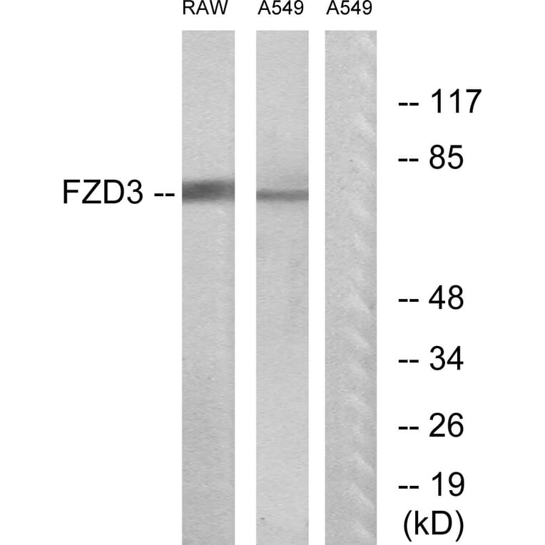 Western Blot - Anti-FZD3 Antibody (G108) - Antibodies.com