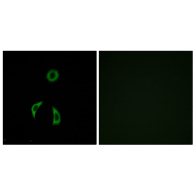 Immunofluorescence - Anti-FZD3 Antibody (G257) - Antibodies.com
