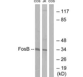 Western Blot - Anti-FosB Antibody (B0930) - Antibodies.com
