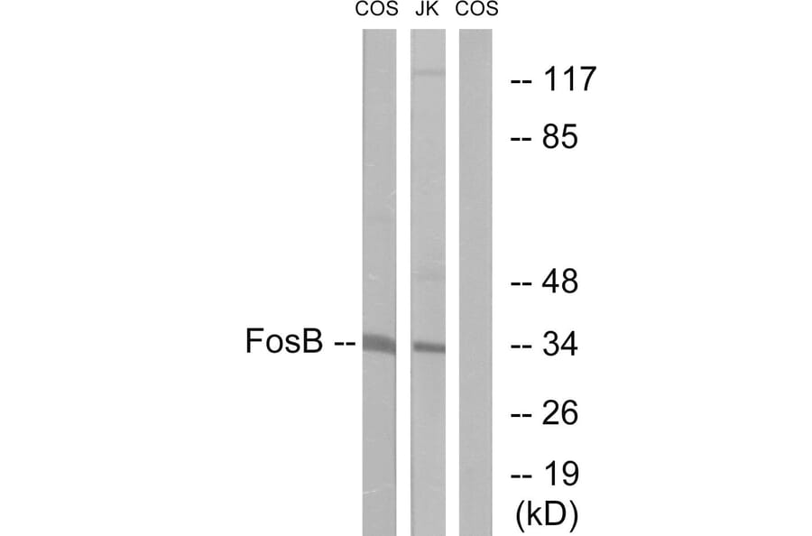 Western Blot - Anti-FosB Antibody (B0930) - Antibodies.com