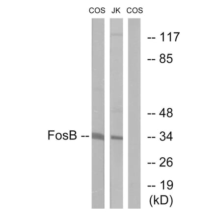 Western Blot - Anti-FosB Antibody (B0930) - Antibodies.com