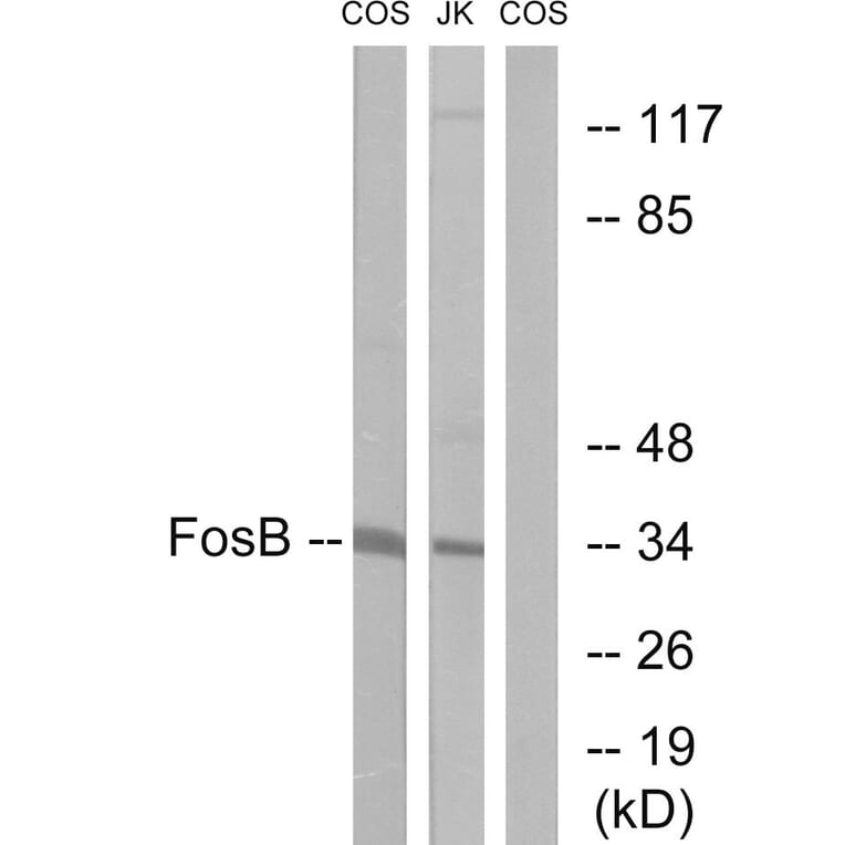 Western Blot - Anti-FosB Antibody (B0930) - Antibodies.com