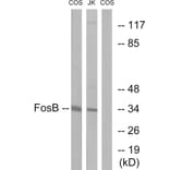 Western Blot - Anti-FosB Antibody (B0930) - Antibodies.com