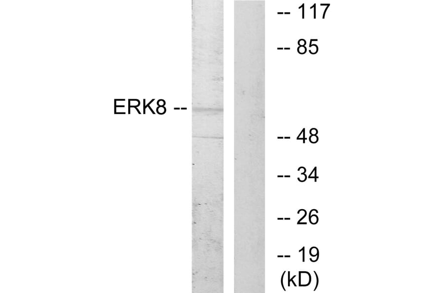 Western Blot - Anti-ERK8 Antibody (B0920) - Antibodies.com